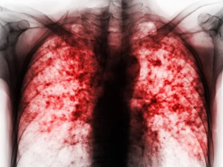 Η πρωτοποριακή νέα ένωση θα μπορούσε να θεραπεύσει την πιο θανατηφόρα μολυσματική ασθένεια στον κόσμο