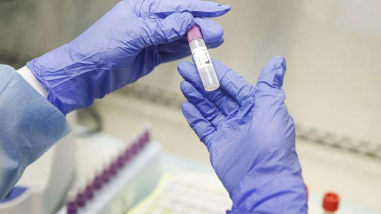 ΕΟΔΥ: Τρεις θάνατοι από COVID-19 την τελευταία εβδομάδα
