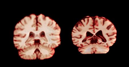 Το παράδοξο του εγκεφάλου και η διαφορά μεταξύ ανδρών και γυναικών