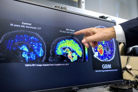 Σοκαριστική Ανακάλυψη: 1 στους 5 Ασθενείς με Καρδιακή Ανεπάρκεια Κρύβει Άνοια πριν τα 65! Ανακαλύψτε πώς η Έγκαιρη Διάγνωση Μπορεί να Σώσει Ζωές!