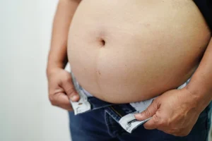 Η θεραπεία της παχυσαρκίας γίνεται «σύστημα δύο επιπέδων», προειδοποιούν οι ειδικοί