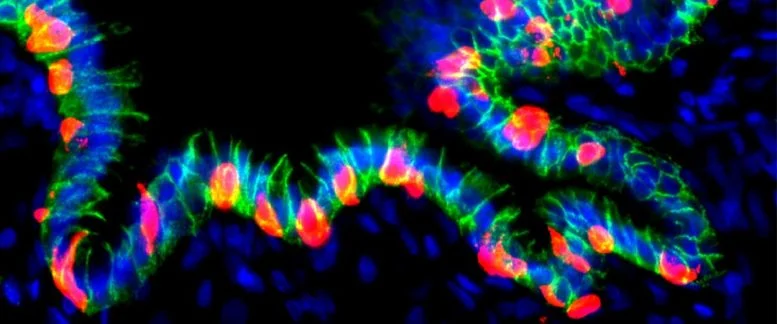 Οι επιστήμονες μόλις μετέτρεψαν τα κύτταρα του στομάχου σε παραγωγούς ινσουλίνης για τη θεραπεία του διαβήτη