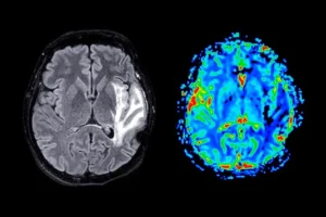Αυτό συμβαίνει στον εγκέφαλό σας κατά τη διάρκεια ενός αγώνα ποδοσφαίρου