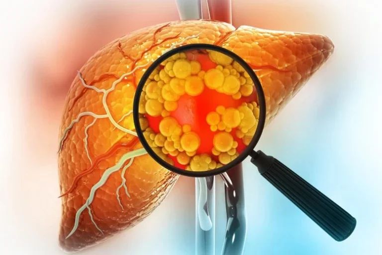 Η Mayo Clinic ανακαλύπτει γενετική ανατροπή που ξαναγράφει τους κανόνες για την κοινή ηπατική νόσο