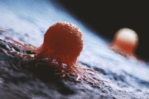 «Η πιο αποτελεσματική θεραπεία μέχρι σήμερα» – Νέα θεραπεία εξαφανίζει τον καρκίνο της ουροδόχου κύστης στο 82% των ασθενών