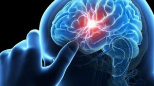 «Ανακαλύψτε το Πρώτο Hellenic Stroke School στην Αθήνα – Μία Επαναστατική Εκπαίδευση που θα σας Σώσει!»