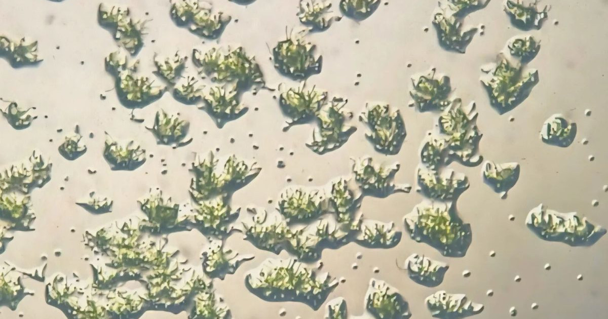 Αυτός ο Μικροοργανισμός Έμεινε Ζωντανός 9 Μήνες στον Διεθνή Διαστημικό Σταθμό – Η Εξερεύνηση της Ζωής στο Διάστημα Μας Αφήνει Άφωνους!