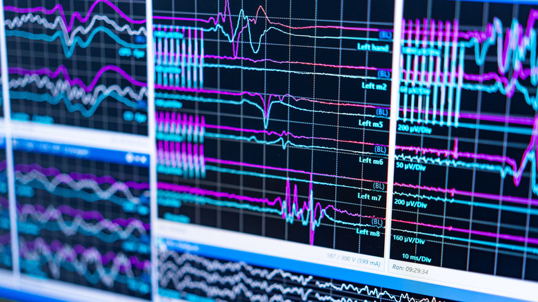 καταγραφή ΗΕΓ