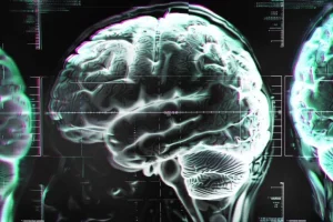 Οι σαρώσεις εγκεφάλου αποκαλύπτουν μια έκπληξη σχετικά με τα φάρμακα για τη ΔΕΠΥ