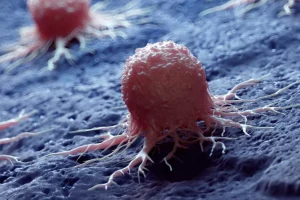 Οι μικροσκοπικές μεταλλικές νανοκουκκίδες εξαφανίζουν τα καρκινικά κύτταρα ενώ σε μεγάλο βαθμό εξοικονομούν υγιή ιστό Οι μικροσκοπικές μεταλλικές νανοκουκκίδες εξαφανίζουν τα καρκινικά κύτταρα ενώ σε μεγάλο βαθμό εξοικονομούν υγιή ιστό