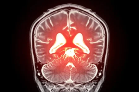 Ένα μόριο του εγκεφάλου που λείπει μπορεί να προκαλεί αγγειακή άνοια