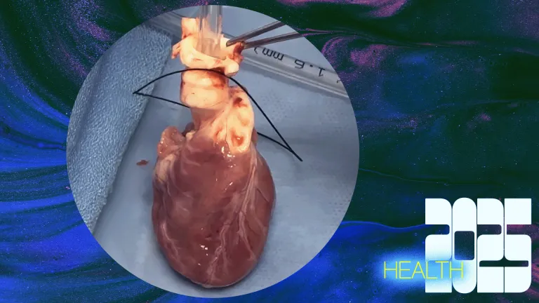 The 50 greatest innovations of 2025 baby heart