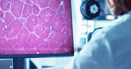 ΕΠΑΝΑΣΤΑΤΙΚΗ ΕΞΕΛΙΞΗ: Εγκρίθηκε το ΠΡΩΤΟ εργαλείο τεχνητής νοημοσύνης που θα αλλάξει τα δεδομένα στις κλινικές δοκιμές φαρμάκων για ηπατική νόσο! ΕΠΑΝΑΣΤΑΤΙΚΗ ΕΞΕΛΙΞΗ: Εγκρίθηκε το ΠΡΩΤΟ εργαλείο τεχνητής νοημοσύνης που θα αλλάξει τα δεδομένα στις κλινικές δοκιμές φαρμάκων για ηπατική νόσο!