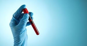 «Αυτή η απλή εξέταση αίματος μπορεί να αποκαλύψει τον κίνδυνο θανάτου σου – Μην την αγνοήσεις!» «Αυτή η απλή εξέταση αίματος μπορεί να αποκαλύψει τον κίνδυνο θανάτου σου – Μην την αγνοήσεις!»