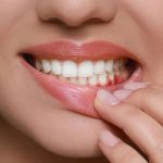 «Προσοχή! Η ουλίτιδα μπορεί να κρύβει σοβαρούς κινδύνους για την καρδιά σας!»