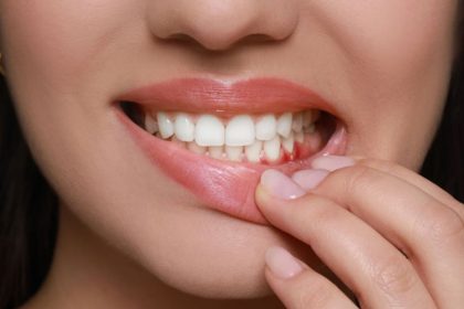 «Προσοχή! Η ουλίτιδα μπορεί να κρύβει σοβαρούς κινδύνους για την καρδιά σας!»