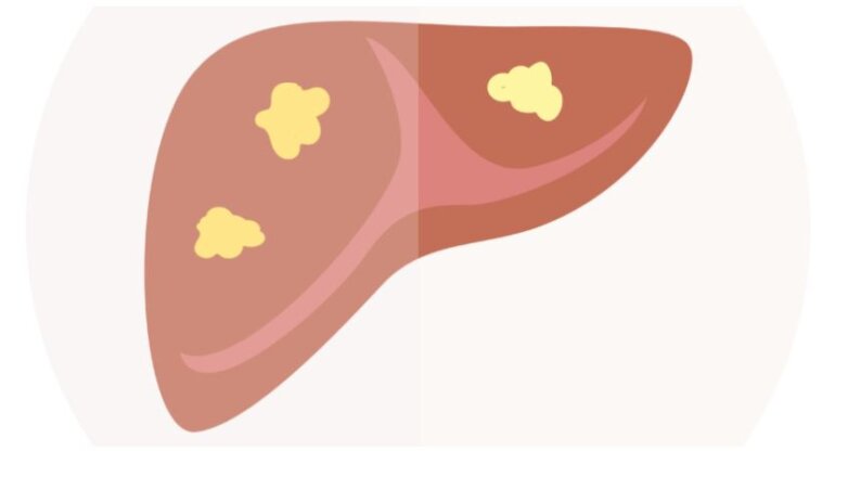 Απίστευτο! Δωρεάν μη επεμβατικός έλεγχος ήπατος στον Πειραιά – Μην τον χάσετε! Απίστευτο! Δωρεάν μη επεμβατικός έλεγχος ήπατος στον Πειραιά – Μην τον χάσετε!
