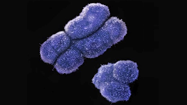 «Ανατρεπτικές Μεταλλάξεις: Το Γενετικό Μωσαϊκό του Σώματός μας! Δείτε Πώς!» «Ανατρεπτικές Μεταλλάξεις: Το Γενετικό Μωσαϊκό του Σώματός μας! Δείτε Πώς!»