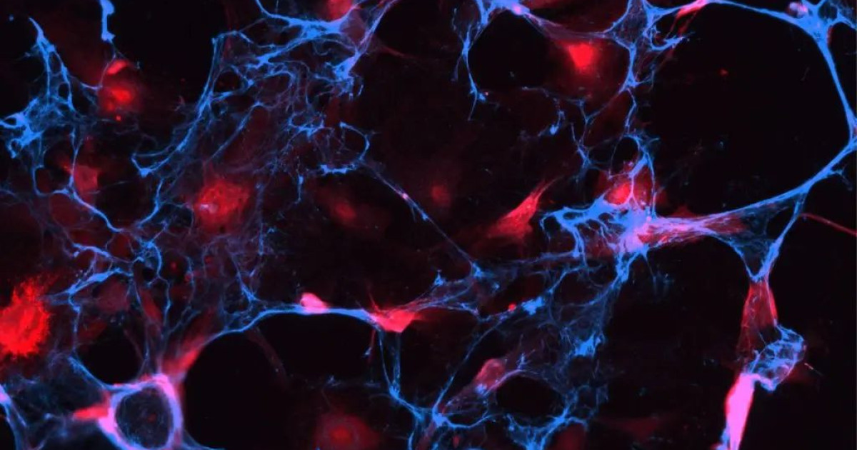 «Η «τρελή» ιδέα φοιτητών που μπορεί να επαναστατήσει στη γήρανση – Μάθε πώς!» «Η «τρελή» ιδέα φοιτητών που μπορεί να επαναστατήσει στη γήρανση – Μάθε πώς!»