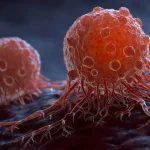 «Καρκίνος: Η Εκρηκτική Παγκόσμια Κρίση Υγείας που Όλοι Πρέπει να Γνωρίζουν!»