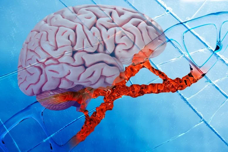 Οι επιστήμονες ανατρέπουν ένα γονίδιο κινδύνου Alzheimer - και αντιστρέφουν τα βασικά χαρακτηριστικά της νόσου