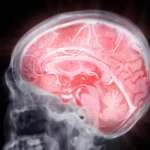 Επιστήμονες ανακάλυψαν «διακόπτες» του εγκεφάλου που βοηθούν να καθαρίσουν τις πλάκες του Αλτσχάιμερ