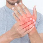 Η νέα ανακάλυψη μπορεί να αποτρέψει τον εξουθενωτικό νευρικό πόνο της χημειοθεραπείας