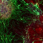 Οι επιστήμονες μόλις αποκάλυψαν πώς χτίζεται ο εγκέφαλος