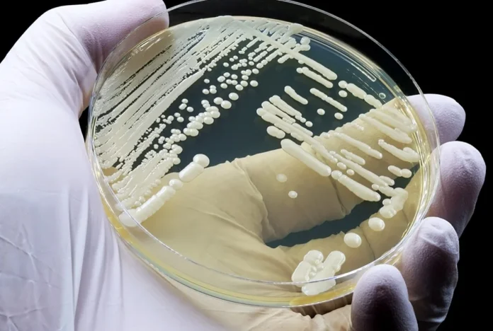 Γνωρίστε τον Candida auris: Ο θανατηφόρος μύκητας που απειλεί όλους μας! Μην πέσετε στην παγίδα!