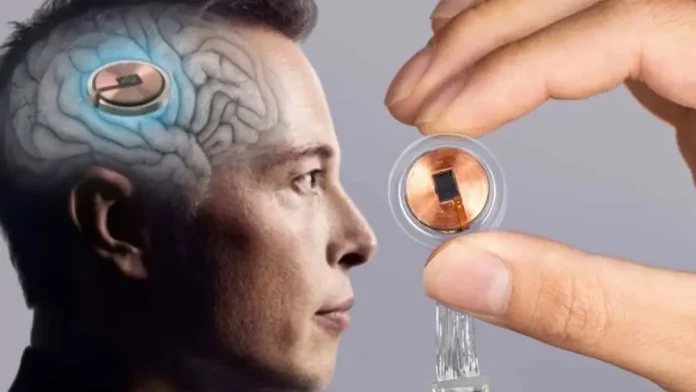«Ανατρεπτικές Αποκαλύψεις του Elon Musk για τη Neuralink: Πώς τα Εγκεφαλικά Εμφυτεύματα Επαναστατούν το Μέλλον!»
