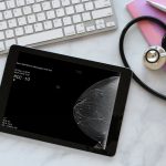 Καρκίνος του μαστού: Ανακαλύψεις που ΘΑ ΣΟΥ ΑΛΛΑΞΟΥΝ την Προσέγγιση στην Πρόληψη!