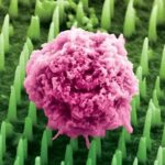 Ιατρική Επαναστατική Πρόοδος 2025: Ελπίδα Ξημερώνει για Ασθενείς με Σπάνιες Νόσους!