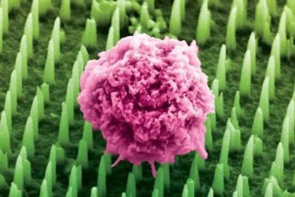 Ιατρική Επαναστατική Πρόοδος 2025: Ελπίδα Ξημερώνει για Ασθενείς με Σπάνιες Νόσους!