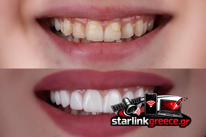 Ανακαλύψτε την Επανάσταση στην Οδοντιατρική - Η Τεχνολογία που Αλλάζει τα Πάντα!