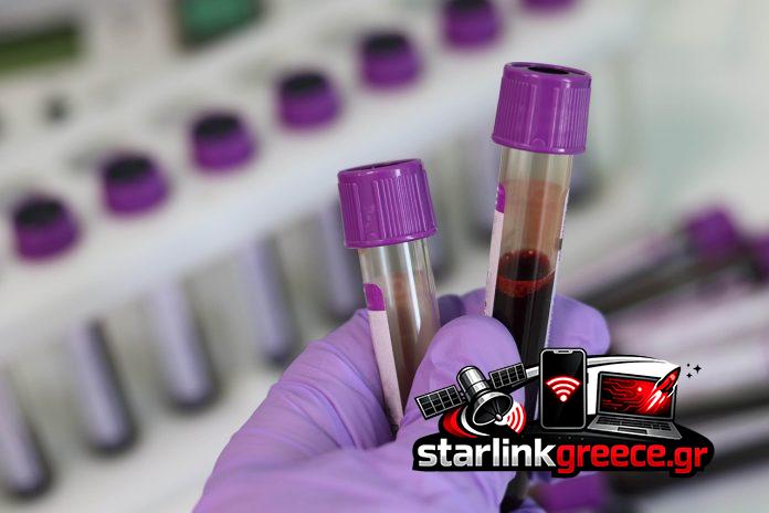 «Κυτταρική θεραπεία επαναστατεί: Ανοσοποιητικό σύστημα γυναίκας»