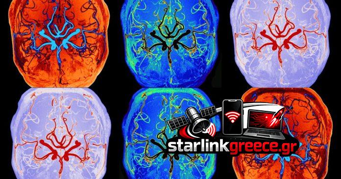 Ανακαλύφθηκε σε πραγματικό χρόνο: Πώς ο εγκέφαλος καθαρίζει κατά τον ύπνο!